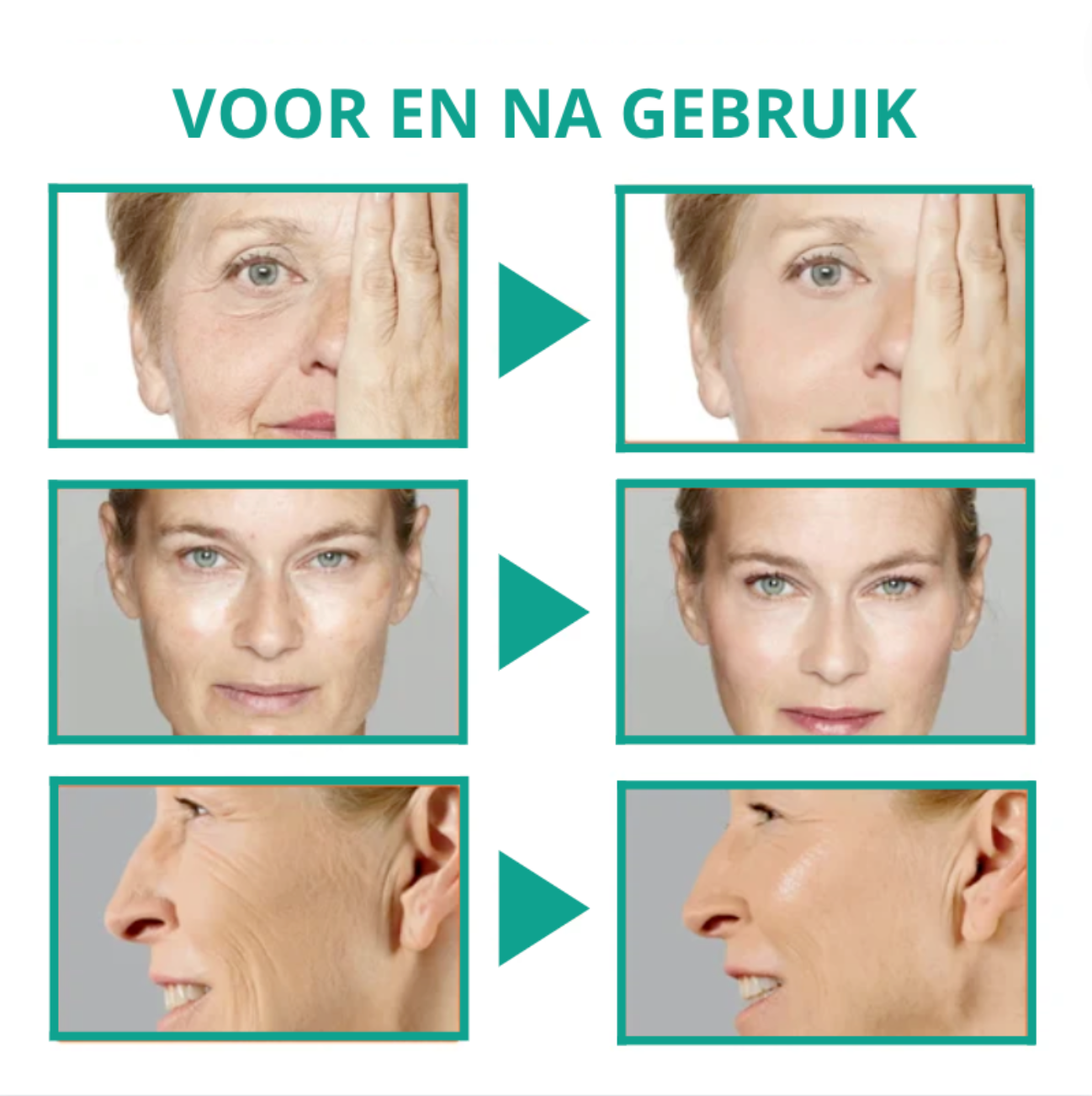 Botox Anti-aging Serum