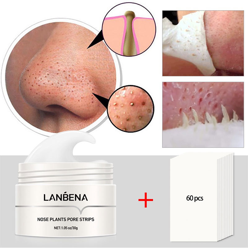 Lanbena™ - Blackhead Remover Crème